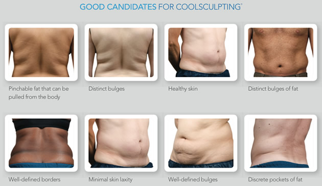 Candidate for Coolsculpting Image