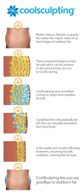 Hoe does Coolsculpting Work